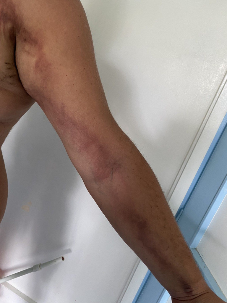 Nenada sam Bog spasio na Krstovdan! Otišao na pecanje, pa ga udario grom: Samo sam se srušio u čamac, ničega se posle ne sećam! (FOTO)