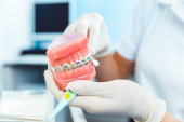 Napredak u stomatologiji: Novi lek omogućava rast trećih zuba