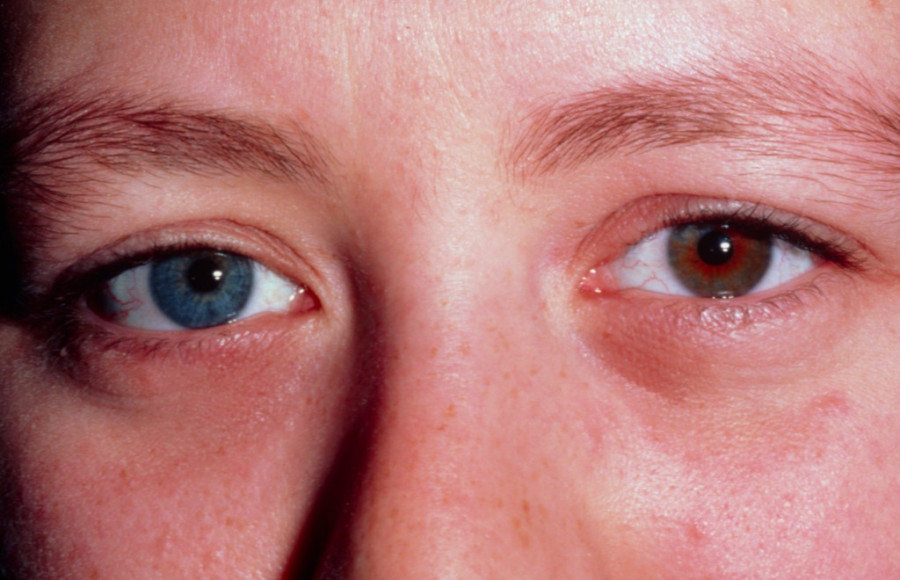 Zelene oči i razmaknuti zubi: Dvanaest fascinatnih karakteristika koje otkrivaju više o vašem zdravlju nego što mislite