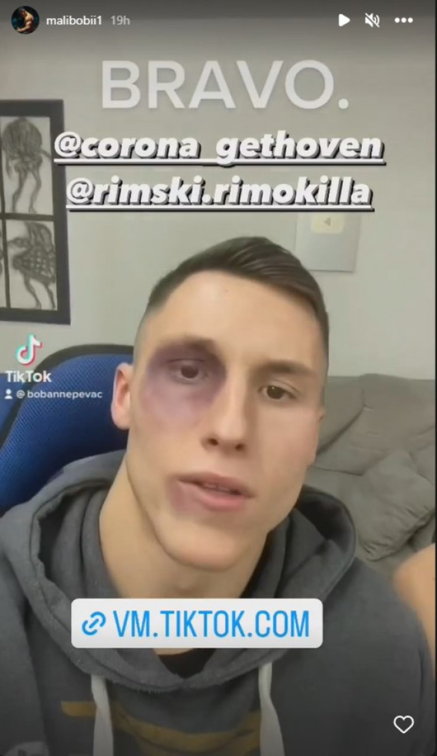 Korona i Rimski pretukli tiktokera?! Boban sa masnicom na oku optužio repere za napad, pa zaplakao! (VIDEO)