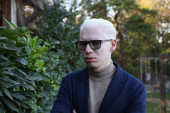 "Imam papir da sam 70 odsto invalid!" Pevač otvorio dušu o zdravstvenom problemu