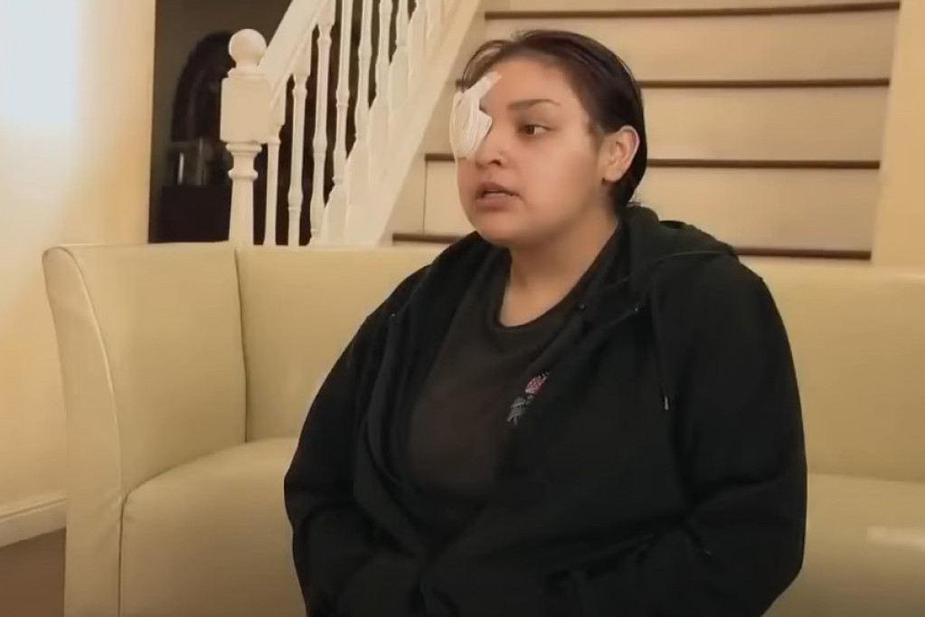 Devojka izgubila oko jer je branila dečaka sa posebnim potrebama od nasilnika (VIDEO)