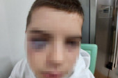 Jezivo vršnjačko nasilje u Surdulici: Dečak (15) posle treninga zadobio teže povrede, otac za 24sedam objasnio šta se dogodilo! (FOTO)
