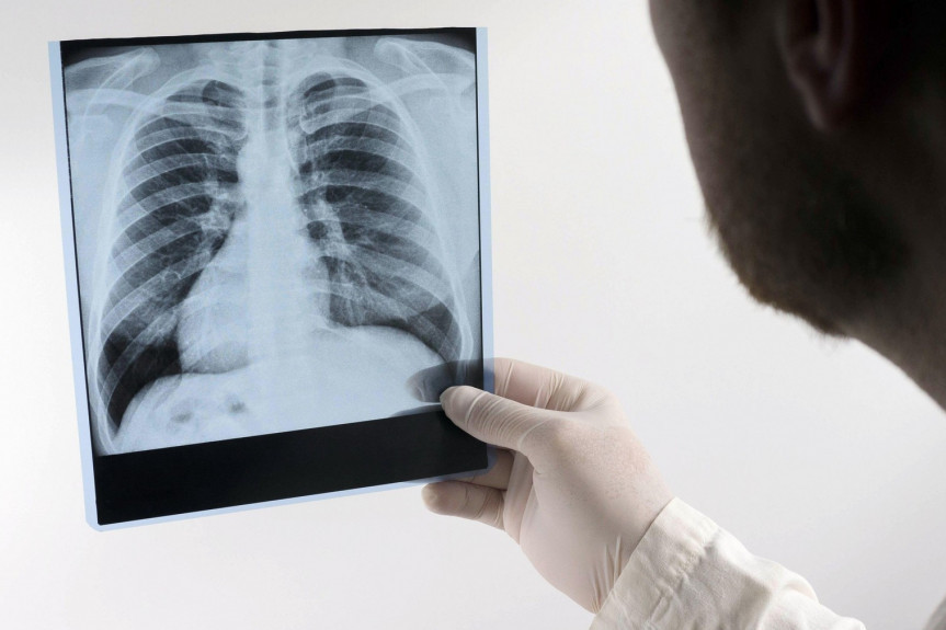 Horor na stanici kod Džakarte: Voz udario u punu kompoziciju, 14 mrtvih! (FOTO/VIDEO)