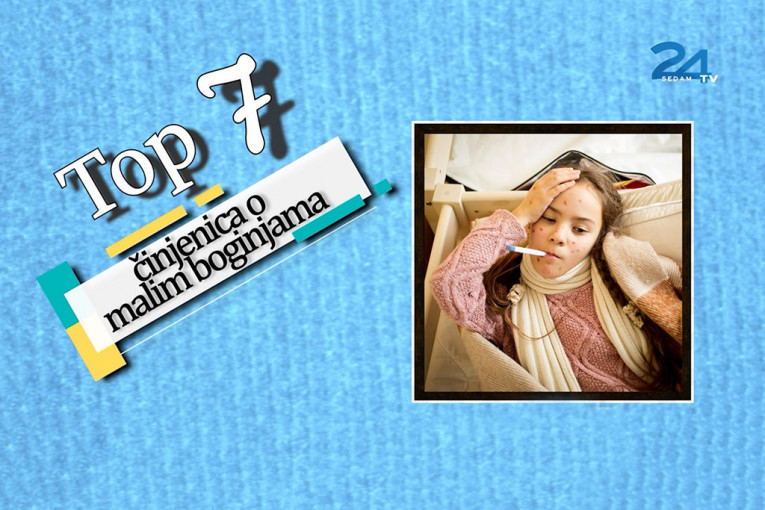 TOP 7 činjenica o malim boginjama: Simptomi u početku kao kod gripa, a postoji samo jedna zaštita