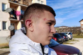 Novi napad na Srbe na KiM: Lazara (15) pretukla četvorica Albanaca na ulici