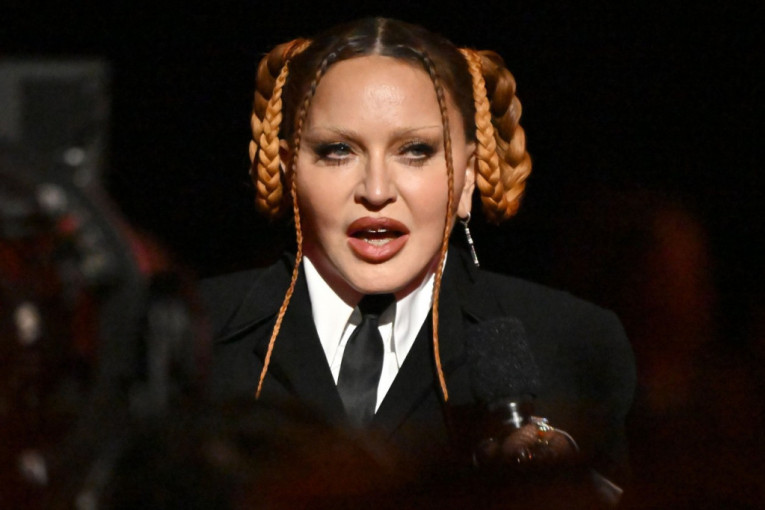 "Liči na vanzemaljca!" Madona zbog plastičnih operacija promenila lični opis: Evo kako je nekada izgledala