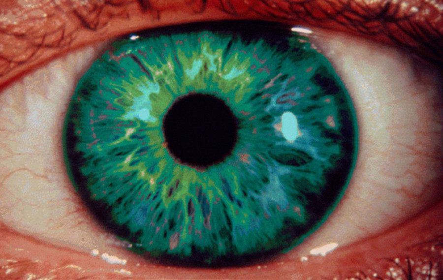 Zašto su zelenooki ljudi retki i posebni?