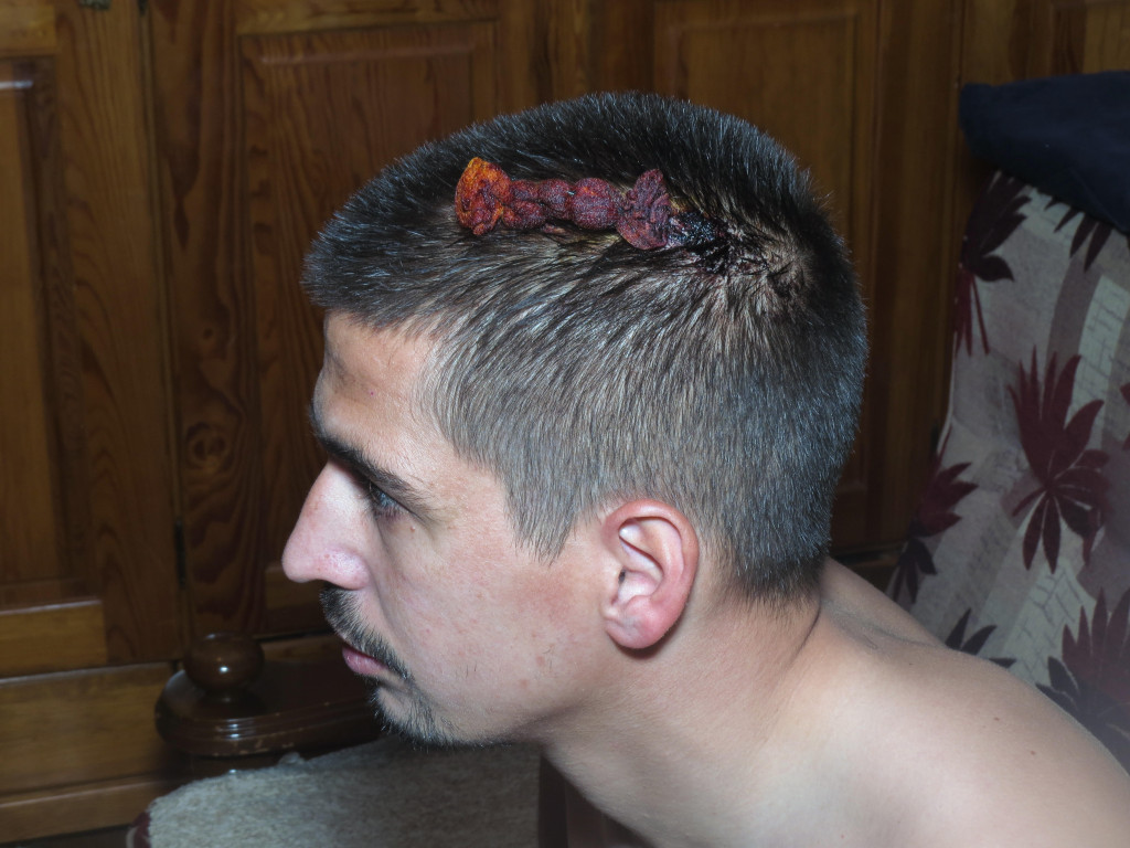 Neverovatan sudski epilog u Čačku: Poštara pretukli u romskom naselju jer nije doneo socijalu, a jedino on osuđen!