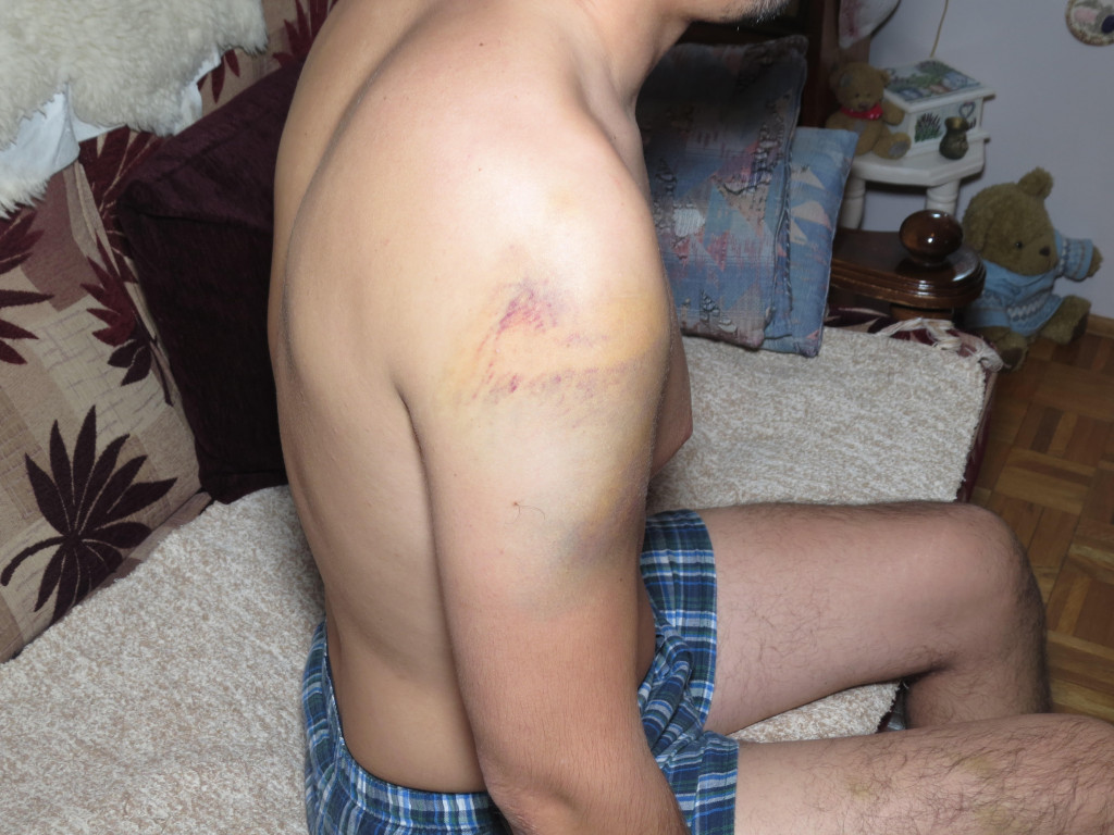 Neverovatan sudski epilog u Čačku: Poštara pretukli u romskom naselju jer nije doneo socijalu, a jedino on osuđen!