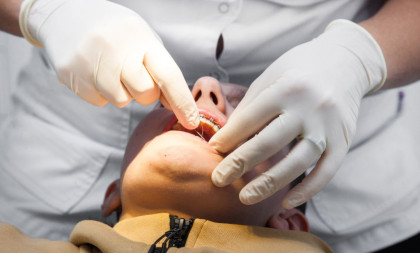 Drama kod zubara u Beogradu: Muškarac dva puta reanimiran tokom vađenja umnjaka