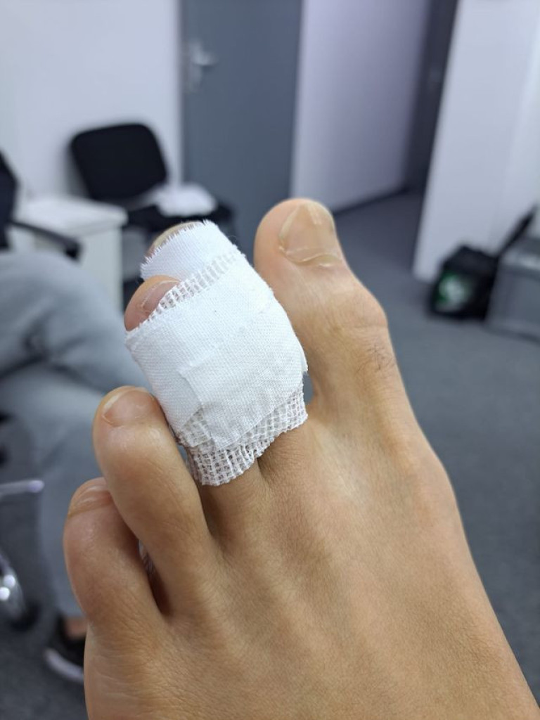 Evo odgovora Špancima koji tvrde da Eksum nije povređen! Idol navijača Partizana igrao pod neopisivim bolovima! (FOTO)