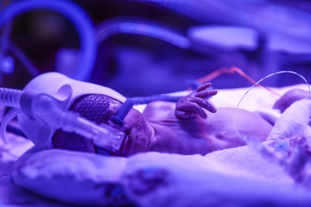 Nova žrtva velikog kašlja, preminula beba u Novom Sadu: Peta žrtva opake bolesti u Srbiji