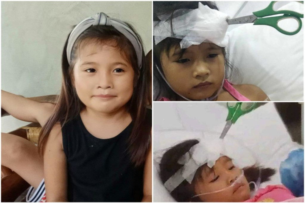 Devojčici se makaze zarile u glavu: Morala tako da leži nedelju dana u bolnici jer nisu imali novca za operaciju