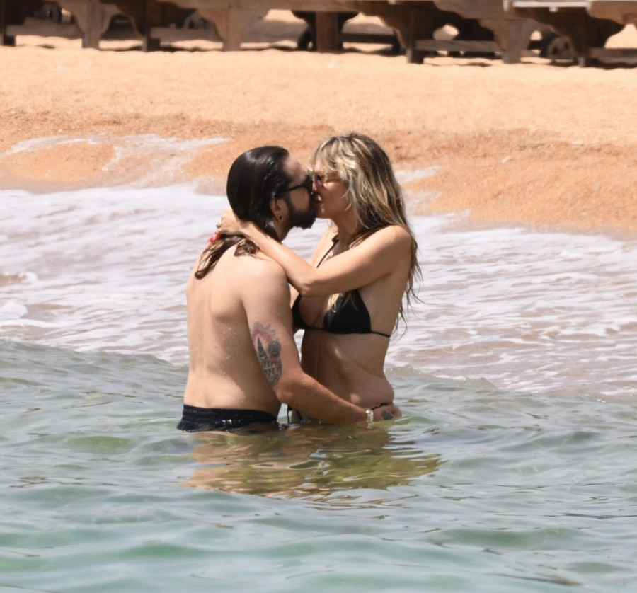 Žizela završila u bolnici: Već 20 dana leži u gipsu, oglasila se iz kreveta (FOTO)