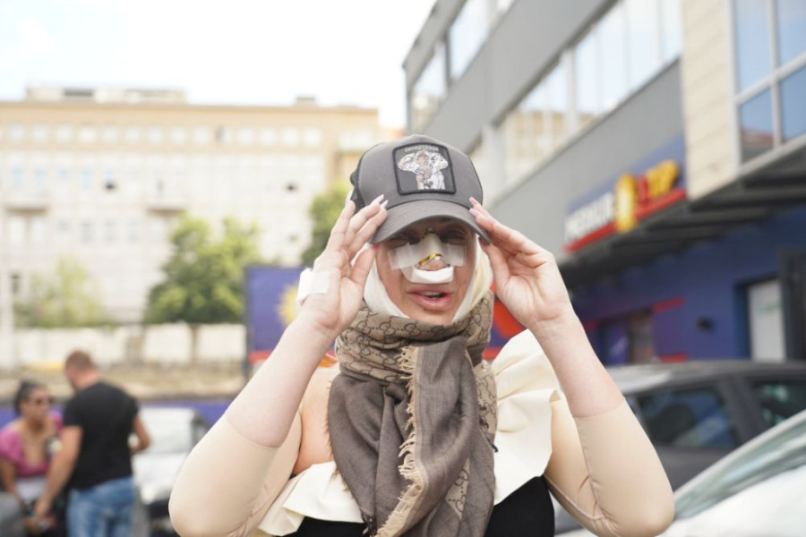 Dušica Jakovljević pokazala novi nos! Čim je skinula zavoje - morala je da se pohvali (FOTO)