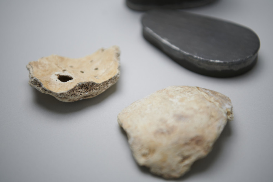 Misteriozni fragmenti ljudske lobanje vraćeni u Beč: Veruje se da pripadaju Betovenu (FOTO)