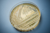 Nova gljivična infekcija pretnja po ceo svet: Može biti veoma opasna, a iza svega stoji..