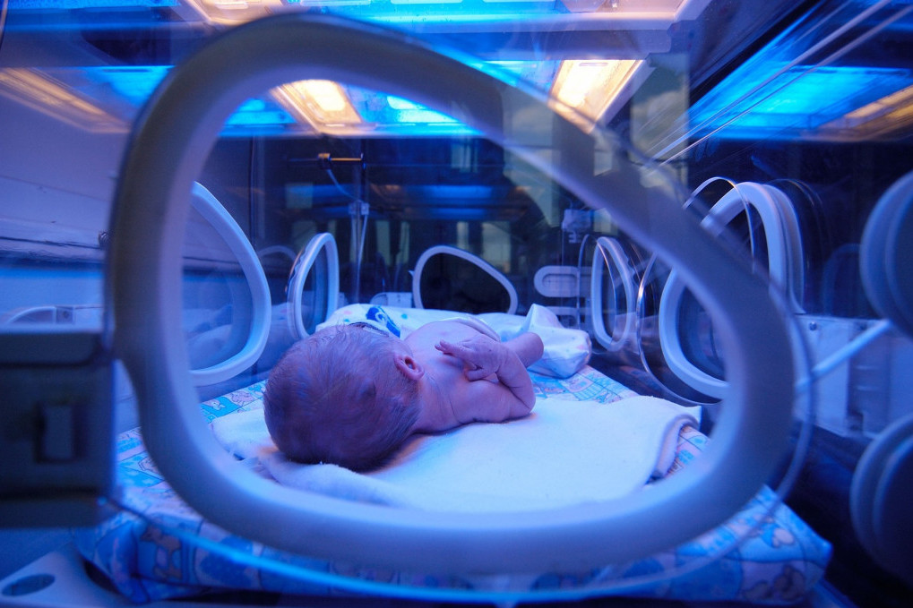 Čak 4.000 prevremeno rođenih beba u Srbiji svake godine: Dete u Institutu za neonatologiju ima samo 430 grama
