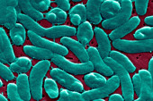Već pet ljudi umrlo od bakterije koja izjeda meso: Evo na šta upozoravaju stručnjaci
