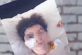 Manijak iz Paraćina iz čista mira pretukao devojku (20) na ulici: Zatvoreno joj oko, polomljena jagodična kost i vilica