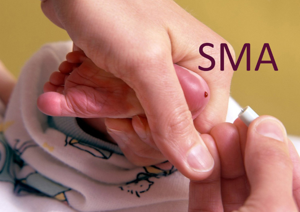 Neonatalni skrining spasava živote: Deset beba dijagnostikovano, sve na terapiji!