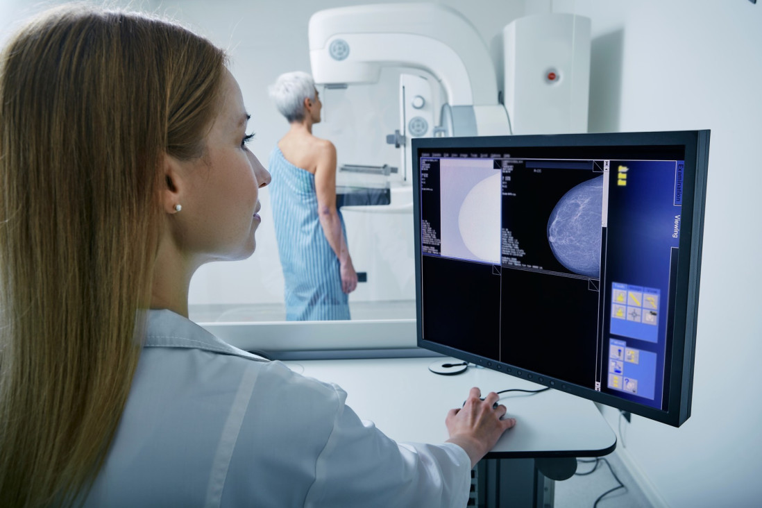 Besplatni mamografski pregledi u Domu zdravlja Voždovac: Evo kako da zakažete termin!
