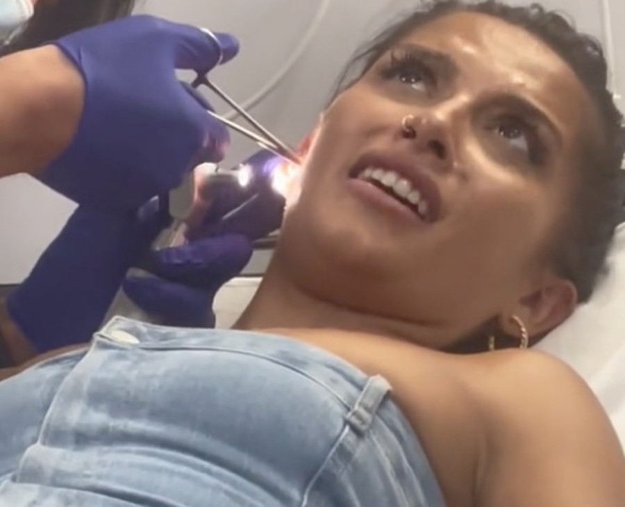 Zgodna Špankinja je otišla lekaru zbog krvi u uhu a onda je doživela šok kad je ugledala stvorenje na pinceti