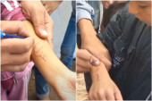 Palestinska deca svoja imena ispisuju na rukama kako bi ih lakše identifikovali ako stradaju: Veoma tužne scene iz Gaze (VIDEO)