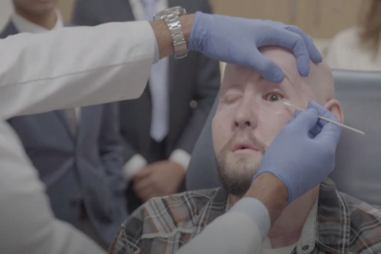 Izvršena prva transplantacija oka na svetu: Pacijenta operisali 21 sat (VIDEO)