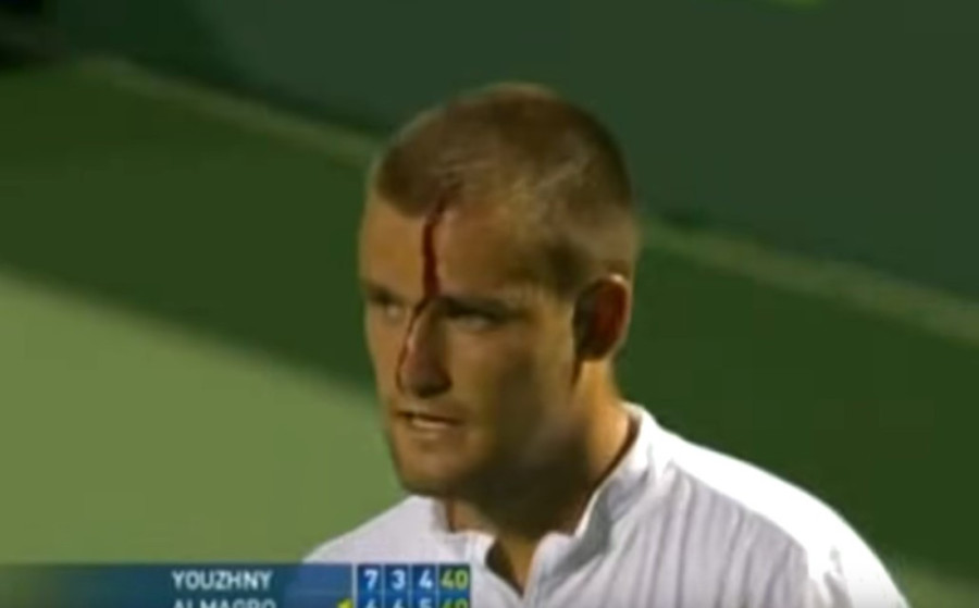 Šta je izdržalo jadno koleno: Rubljov izgubio razum! Čudo kako se nije teže povredio! (VIDEO)