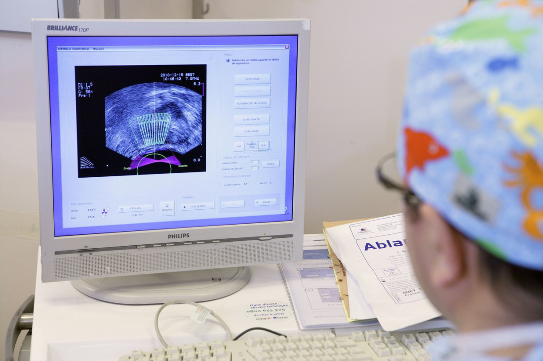 Prognozirali im nekoliko meseci života, a oni preživeli najteže kancere: Lekari napokon otkrivaju zašto su neki "otporni" na rak