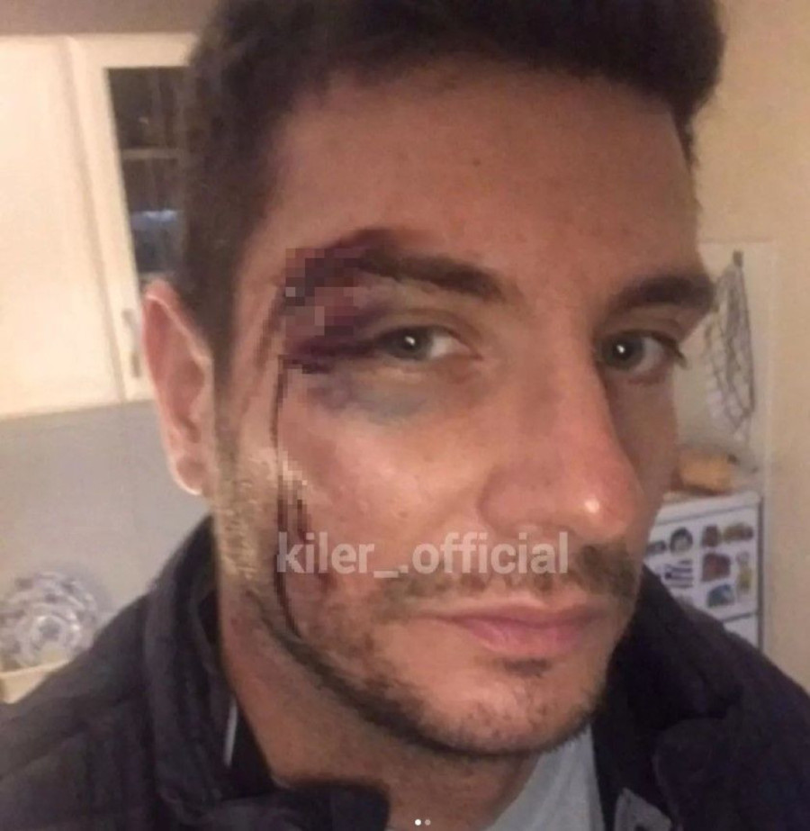 Tarin bivši je jedan od trojice koji su brutalno pretukli nekadašnjeg zadrugara? Oglasio se njegov otac: Umalo da mi ubije sina!