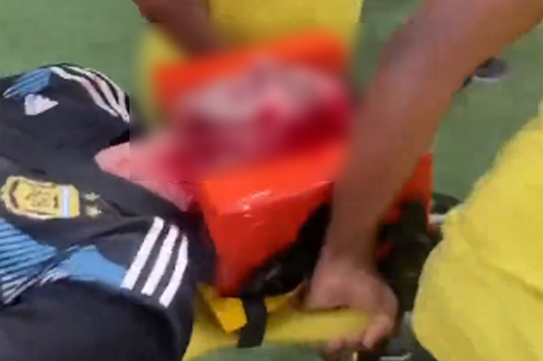 Uznemirujuće scene! Pretučen navijač na Marakani, jaukao od bolova, razbijene i krvave glave! (VIDEO)