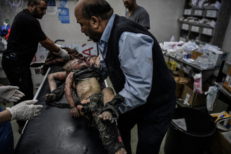 Gore nego u horor filmovima: U dečjoj bolnici u Gazi novinari zatekli užasavajuće scene, tela mališana su se raspala pred njima (VIDEO)