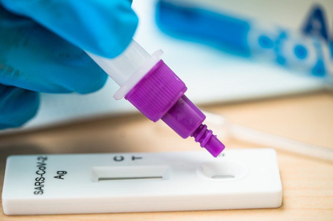 Naučnici konačno na pragu rešenja misterije! Evo zašto su neki dobili koronu, a neki nisu