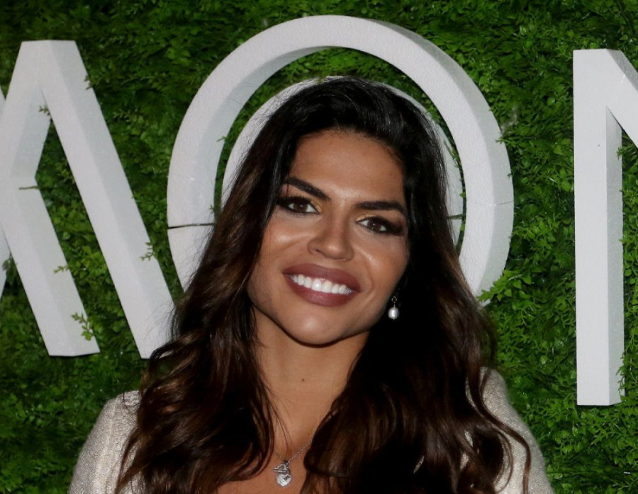 Srpska manekenka imala brojne operacije, a sad priznaje: Došlo je do toga da ne ličim na sebe, doktori su krivi