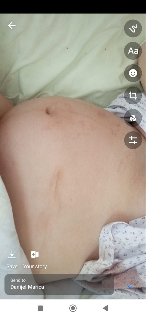 Advokatica otkrila kolika kazna preti ginekologu koji je osumnjičen za nasilje nad porodiljom i smrt bebe u Sremskoj Mitrovici!