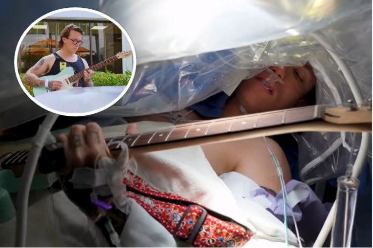 Čudo neviđeno: Budan svira gitaru dok mu lekari čeprkaju po mozgu (VIDEO)
