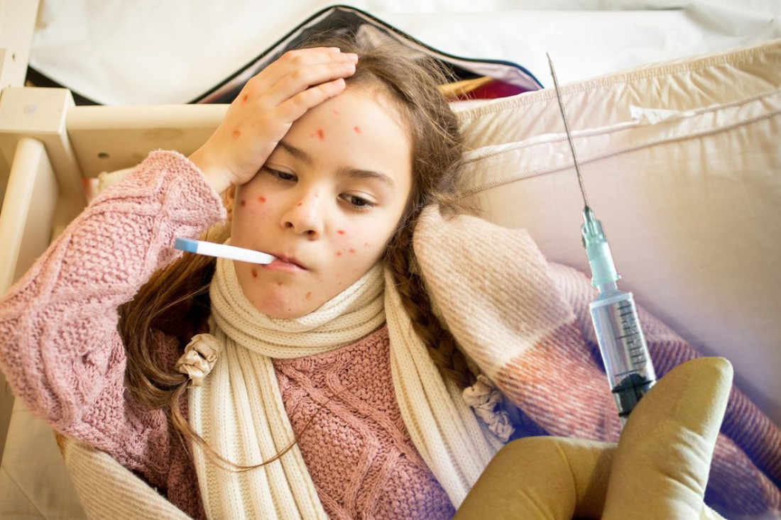 Opasna zarazna bolest hara u Nišu: Napala decu u vrtiću, a desila se i porodična epidemija!