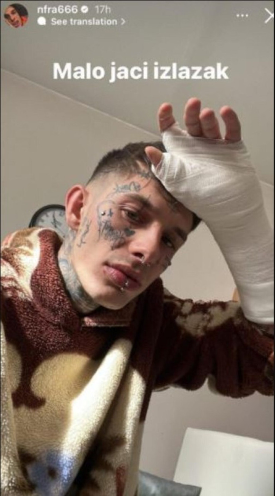 Fran Pujas sa gipsom na ruci, sav u povredama: Malo jači izlazak!