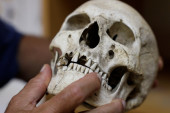 Kakav vam je to posao da kopate tuđa groblja?! Antropolog otkriva: Ljudi su lečili migrenu bušenjem lobanje!