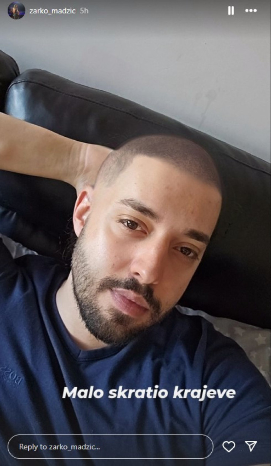 Pojavljivao se polugo na sceni, a devojke su padale na njegovu dugu, talasastu kosu: Pevač sada ne liči na sebe (FOTO)