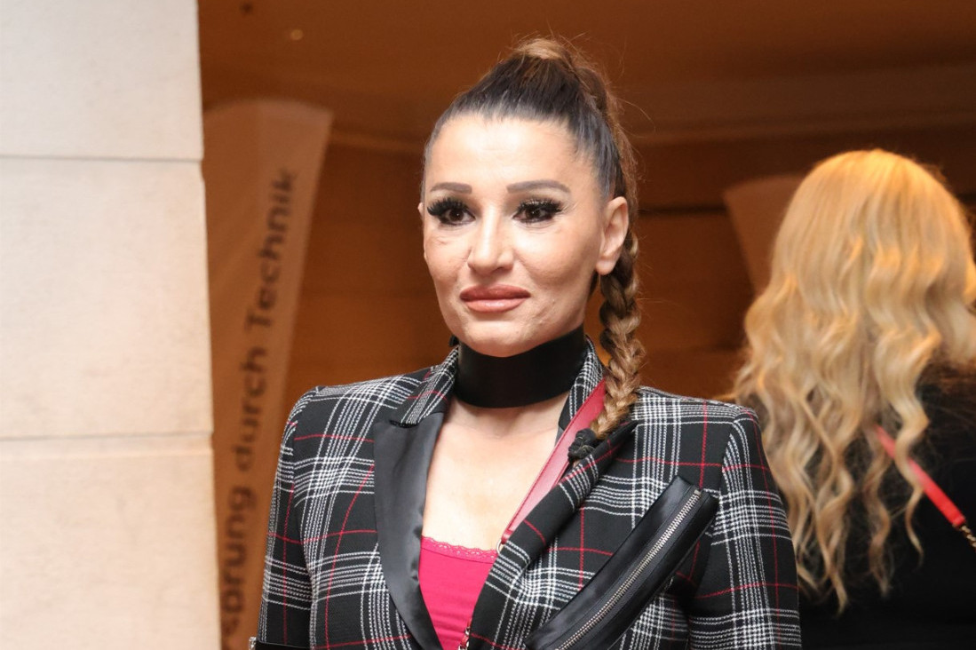 "Doktor mi je saopštio surovu istinu!" Mira Škorić vodila bitku sa opakom bolešću: Bila sam u stanju šoka!