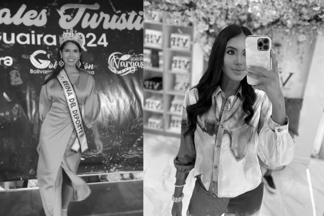 Misica preminula nakon operacije na licu: Imala je samo 24 godine