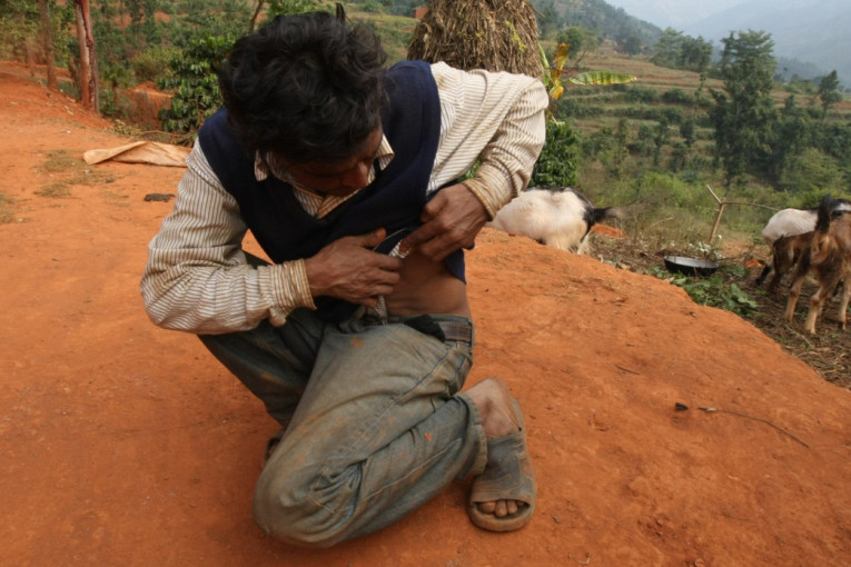 Patnja u "Dolini bubrega": U ovom selu u Nepalu skoro svi su prodali bubreg, a onda se sudbina podlo poigrala sa njima