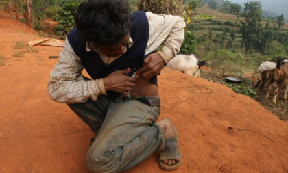 Patnja u "Dolini bubrega": U ovom selu u Nepalu skoro svi su prodali bubreg, a onda se sudbina podlo poigrala sa njima