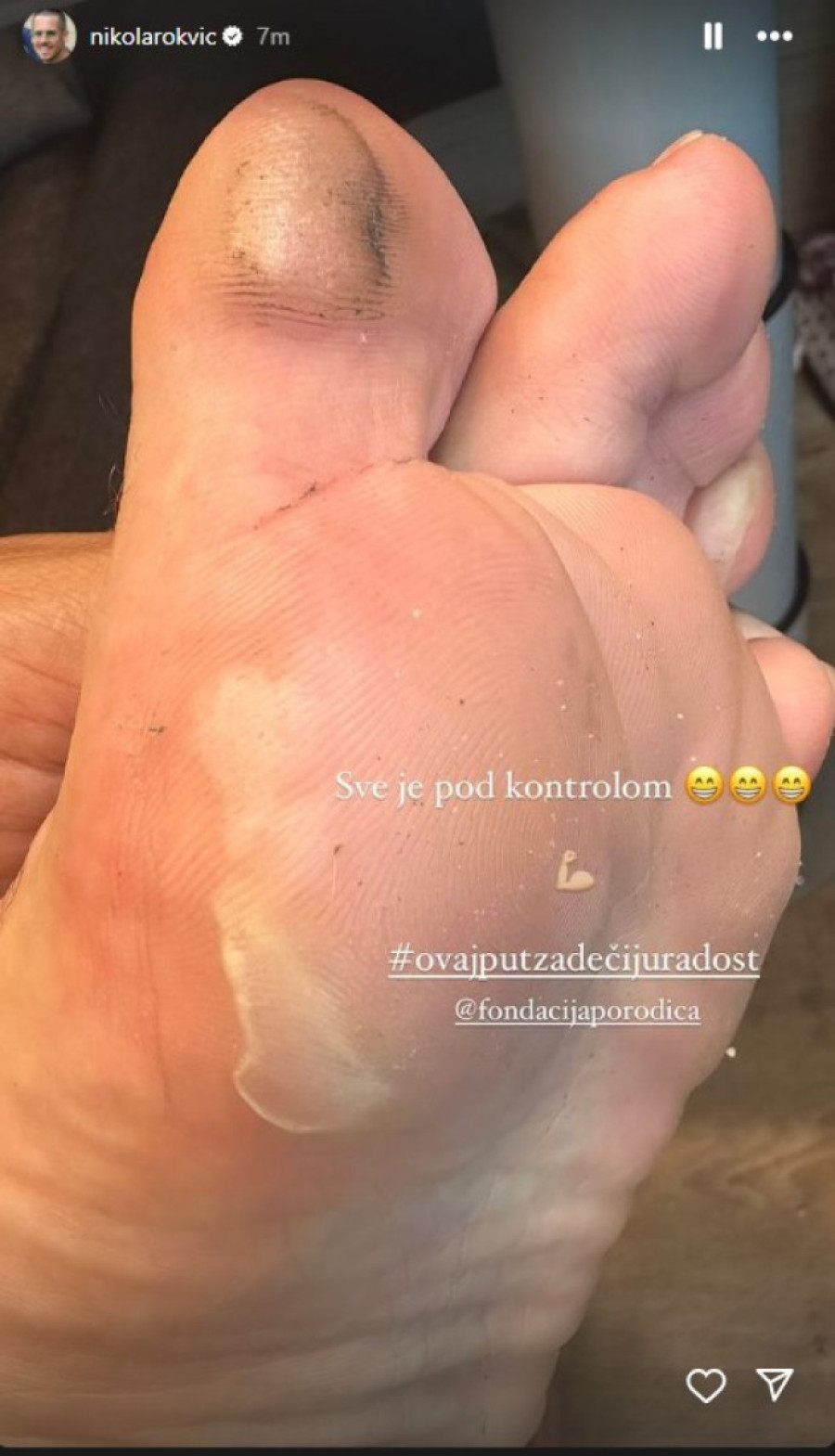 Put Nikole Rokvića do Grčke ostavlja posledice na njegovo telo: Pevač pokazao šta mu se desilo (FOTO)