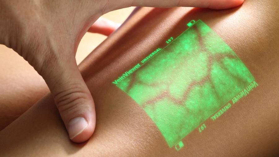 Pionir laserskih operacija: Dr Petar Dragić postavlja globalne standarde u lečenju vena