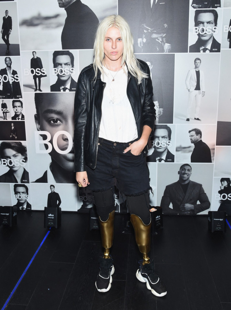 Manekenki amputirane obe noge jer je koristila tampon: Ali ovo može da se desi svakoj devojci!